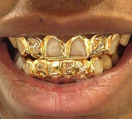 Mouth Grillz, Gold Teeth Grills, Gold Grills, Teeth Grills, Teeth Gems, Pretty Teeth, Grillz Teeth, Diamond Grillz, Gold Grill