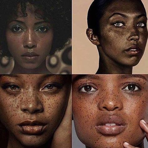 4,899 Likes, 361 Comments -  Taz's Angels (@tazsangels_) on Instagram: “Obsessed. ❤️ BBLU  Tag a baddie with freckles.   Embrace Flaws.” Freckles On Dark Skin, Black Girls With Freckles, Black Freckles, People With Freckles, Women With Freckles, Beautiful Freckles, Faux Freckles, Freckles Girl, Freckle Face