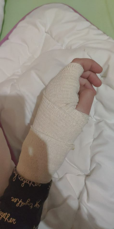 Hand With Bandage, Lockscreen Iphone Quotes, Room Snapchat Stories, Hospital Room Snapchat, Room Snapchat, Fake Injury, Hospital Room Snapchat Stories, Hospital Admit, Camera Tattoo