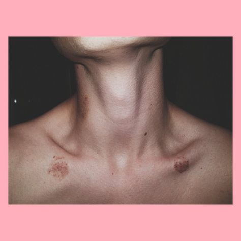 Hicks On Neck Aesthetic, Hickey On Boy, Aesthetics Hickeys, Love Bites Hickey For Boys, Hickey Neck Aesthetique, Love Bites Hickey, 2024 Relationship, Neck Full Of Hickeys, Hicks On Neck