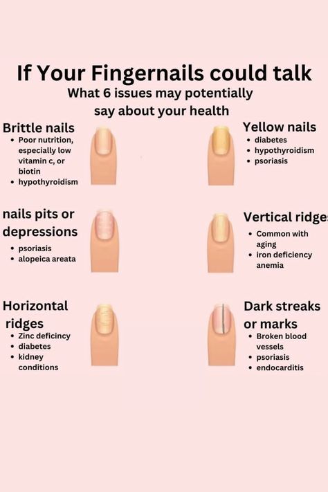 History Of Nail Polish, Fingernail Health, Nail Theory, Nail Disorders, Nail Tech School, Nails Shape, Nail Problems, Sleeping Well, Nail Infection