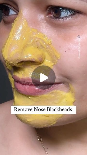 𝑩𝒆𝒂𝒖𝒕𝒊𝒇𝒖𝒍 𝒀𝒐𝒖 𝑻𝒊𝒑𝒔 on Instagram: "Nose & Chin blackhead, Whitehead removal, easy home-made remedy. Try this weekly, two time and you get best result get rid of blackhead Whitehead dead skin and get glass like shiny, healthy skin from your nose and chin areas, especially also you can ask me if you have any query or any doubt in the comment section Love to answer.❤️. . . . . . Follow for more. #skincare #beauty #beautytips #reels #blackheads" Home Remedy For Blackheads On Nose, Home Remedies For Blackheads, Nose Blackheads Removal At Home, How To Remove Black Heads, How To Remove Blackheads At Home, How To Remove Blackheads From Nose, Black Heads Removal Homemade, Remove Blackheads From Nose Homemade, Black Head Remover Diy