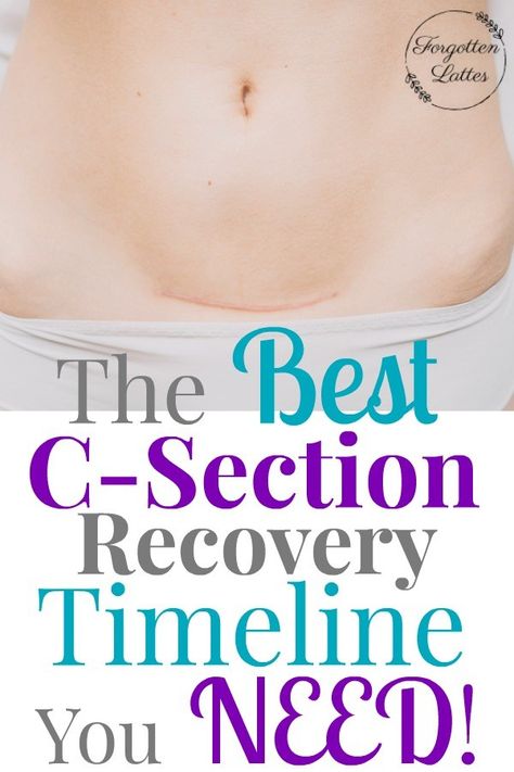 After experiencing two c-sections I decided it was finally time to write down a c-section recovery timeline. This helped me to stay encouraged and focused in my recovery after my second c-section. #csection #csectionrecovery #pregnancy #csectionrecoverytimeline #postpartum #postpartumrecovery #baby #motherhood #parenting After Csection Workouts, Recovery After C Section, After Csection Recovery Tips, Cesarian Section Recovery, Exercise After C Section, Cesarian Section, C Section Recovery Timeline, Stay Encouraged, Cesarean Delivery