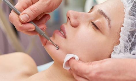 What are Facial Extractions? | Skincare.com Facial Extractions, Cosmetology Tips, Facial Ideas, Acne Tool, Teenage Acne, Cleanliness Is Next To Godliness, Forehead Acne, Comedone Extractor, Aesthetic Center