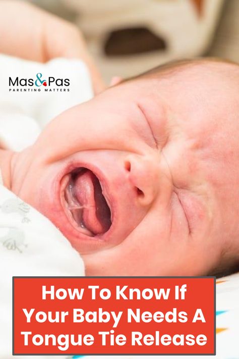 There are many reasons why mums can find it hard to breastfeed their babies but one reason that is growing in awareness is that of tongue-tie. But what is tongue tie exactly and how do you know if your baby has it? How do you know if tongue tie is affecting your baby’s breastfeeding and what can you do about it?We explore all this including tongue tie release procedures, and what help is available to new mothers below. #babies #parentingtips #babyissues #tonguetie #breastfeedingtips Baby Advice For New Parents, Newborn Breastfeeding Tips, Baby Tongue, Newborn Breastfeeding, Face Transformation, Pediatric Pt, Advice For New Parents, Feeding Therapy, Breastfeeding Positions