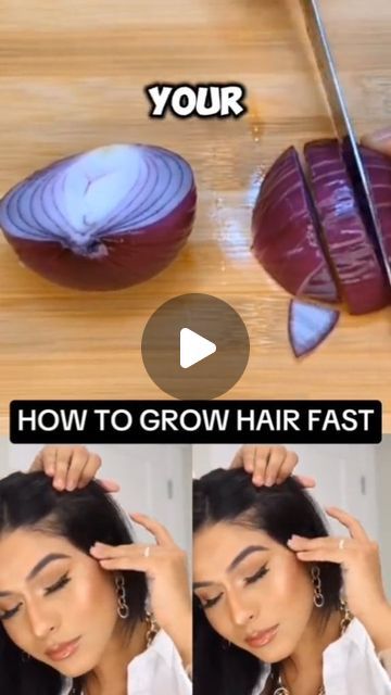 HealthTipssssss on Instagram: "HOW TO GROW HAIR FAST 
#hairgrowth #hairloss

#hairgrowthoil #naturalrecipe" Hairloss Diy Home Remedies, How To Grow Hair Fast, How To Grow Thicker Hair, How To Make Your Hair Grow Faster, How To Grow Hair Faster, Hair Grower, How To Grow Hair, Longer Hair Faster, Thick Hair Growth