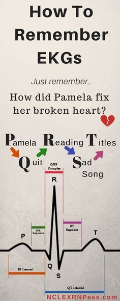 EKG interpretation made easy. If you are a nursing student looking for help with learning and understanding 12 lead ekgs and cardiac rhythms this article is for you! Cardiology is no joke in nursing school so sometimes you have to bring complicated concepts back to the basics. Simple steps to understand EKGs #ekginterpretation #nclex #nursingstudents #nursingschool EKG interpretation made easy. If you are a nursing student looking for help with learning and understanding 12 lead ekgs and cardiac Ekg Interpretation, Medical Assistant Student, Nursing Information, Nursing Mnemonics, Cardiac Nursing, Nursing School Survival, Nursing Life, Nursing School Studying, Respiratory Therapy