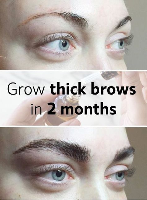 How to grow eyebrows and eyelashes Make Eyebrows Grow, How To Make Eyebrows, Thicker Eyebrows Naturally, Grow Eyebrows Thicker, Sparse Eyebrows, How To Grow Eyebrows, Thick Brows, Eyebrow Growth, Threading Eyebrows