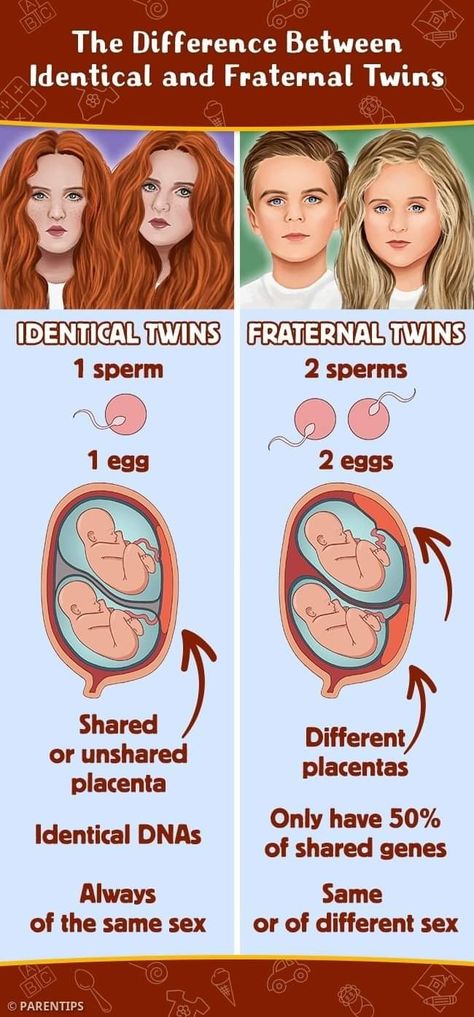 Fraternal Twins, Identical Twins, Biology, Twins, Stuff To Buy, Quick Saves