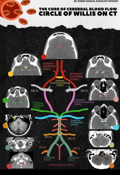 Ct Scan Brain Anatomy, Medical Radiography, Nurse Teaching, Radiology Student, Medicine Notes, Medical School Life, Psychology Courses, Medicine Studies, Radiology Technologist