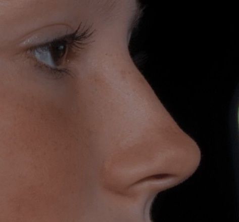 Nose References, Greek Nose, Nose Job Inspo, Upturned Nose, Dream Nose, Hooked Nose, Rhinoplasty Nose Jobs, Nose Jobs, Straight Nose