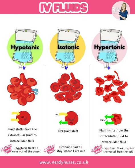 Lauren - Nursing made easy on Instagram: "Understanding IV Fluids: Hypotonic, Isotonic, and Hypertonic Solutions for Student Nurses  1. Isotonic Fluids What They Are: - Isotonic fluids have the same osmolarity as blood plasma (about 275-295 mOsm/L). - They expand the extracellular fluid (ECF) without causing a shift in fluid between compartments.  Common Examples: - 0.9% Sodium Chloride (Normal Saline) - Hartmanns solution - 5% Dextrose in Water (D5W) - initially isotonic, but becomes hypotonic as dextrose is metabolized  Uses: - To treat dehydration - To replace fluid losses (e.g., haemorrhage, surgery) - To maintain fluid balance during surgery  2. Hypotonic IV Fluids What They Are: - Hypotonic fluids have a lower osmolarity than blood plasma (<275 mOsm/L). - They cause water to move int Intracellular And Extracellular Fluid, Fluid Balance Nursing, Fluid Electrolyte Balance Nursing, Fluid Volume Deficit Nursing, Isotonic Hypotonic Hypertonic, Iv Solutions, Extracellular Fluid, Nerdy Nurse, Medical Study