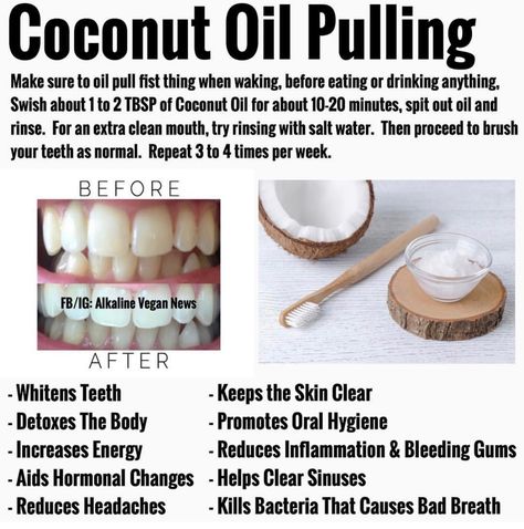 Use coconut oil BEFORE brushing your teeth for these incredible health benefits. Tantric Yoga, Holistic Health Remedies, Benefits Of Coconut, Coconut Oil Pulling, Teeth Health, Benefits Of Coconut Oil, Oil Pulling, Beauty Tricks, Natural Health Remedies