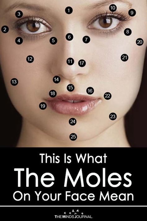 This Is What The Moles On Your Face Mean - https://themindsjournal.com/this-is-what-the-moles-on-your-face-mean/ Tattoo Mole, Miraculous Redesign, Mole Meaning, Dark Mole, Moles On Face, Gallbladder Health, Skin Moles, Skin Growths, Mole Removal