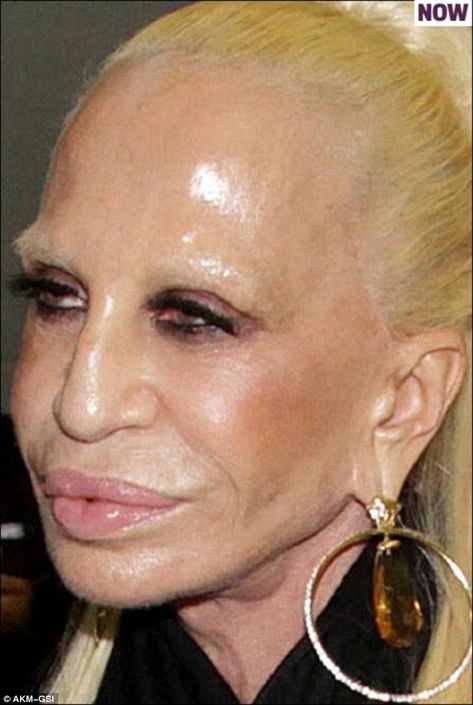 How Donatella Versace transformed herself into a human waxwork | Daily Mail Online Extreme Plastic Surgery, Plastic Surgery Photos, Tot Bag, Laser Resurfacing, Celebrity Plastic Surgery, Under The Knife, Homemade Face Masks, Homemade Face, Donatella Versace