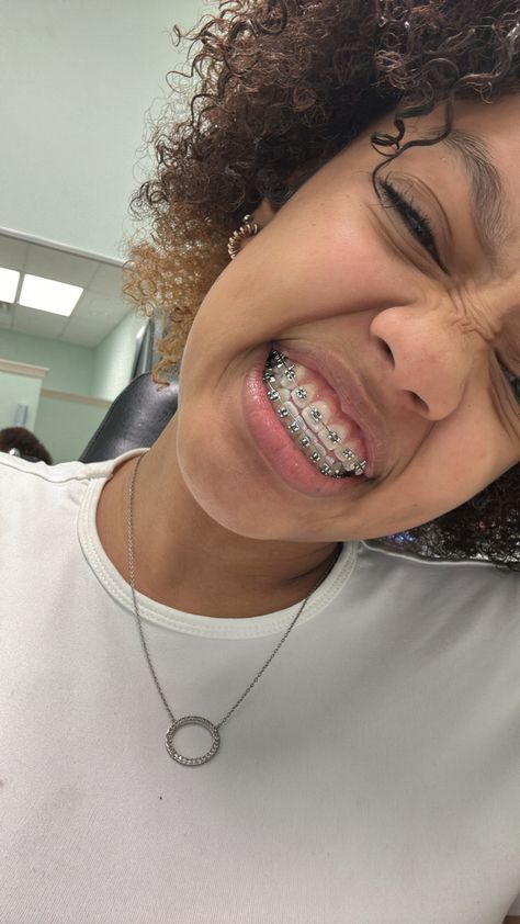 Power Chain Braces, Dental Braces Colors, Silver Braces, Pretty Backrounds, Cute Braces Colors, Teeth Aesthetic, Pretty Teeth, Braces Tips, Getting Braces