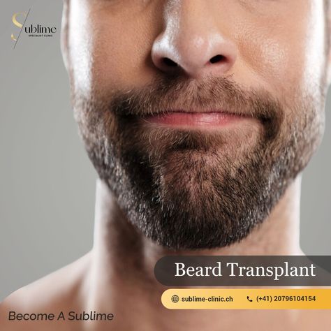 Embrace the beard you've always dreamed of with our expert beard transplant services. Unleash your confidence, one follicle at a time. Visit at:- #hairtransplant #hairtransplantation #haartransplant #haartransplantation #hairtreatment #greffedecheveux #transplantecabelo #transplantecapilar #turkeyhairtransplant #beardtransplant Stylish Beards, Beard Transplant, Hair Transplant, Switzerland, How To Become, Confidence, Hair