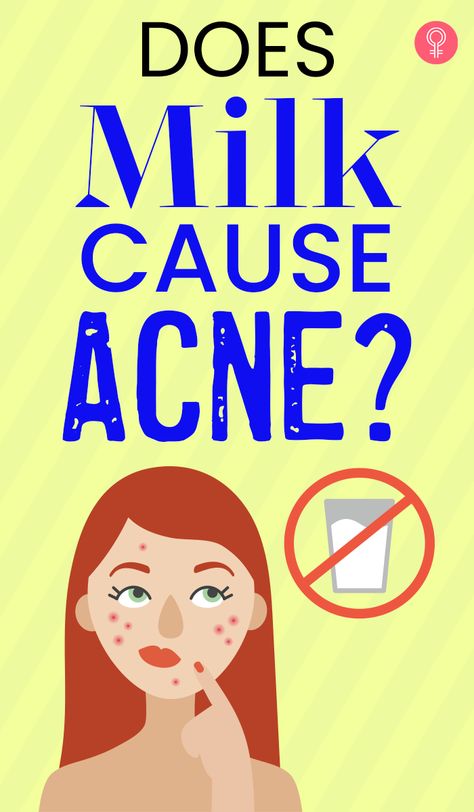 Milk Skincare, Blind Pimple, Makeup Ingredients, Milk Allergy, Pimples Remedies, Tips For Acne, Acne Vulgaris, Oil Based Cleanser, Global Population