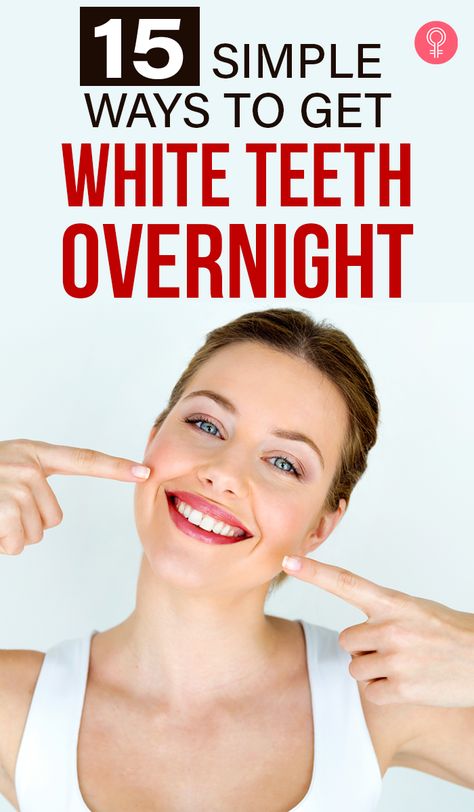 15 Simple Ways To Get White Teeth Overnight: Home remedies for teeth whitening are popular as, unlike dental procedures, they pose little to no risk of weakening or damaging your natural teeth. Additionally, they are inexpensive and do not require insurance or burning a hole in your pocket to be effective. You can use ingredients that are probably already in your kitchen or cupboard. #remedies #homeremedies #teethwhitening White Teeth Overnight, Toothache Relief, Teeth Whiting At Home, Diy Teeth, Remedies For Tooth Ache, Get Whiter Teeth, Teeth Whitening Remedies, Whitening Teeth, Loose Tooth