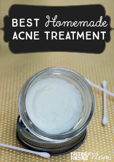 Making Homemade Beauty Products Is Easy. These 14 DIY Recipes Prove It Remedy For Acne, Drugstore Products, Skin Care Routine For 20s, Diy Acne, Natural Acne Remedies, Natural Acne, Natural Healing Remedies, Acne Spots, Acne Remedies