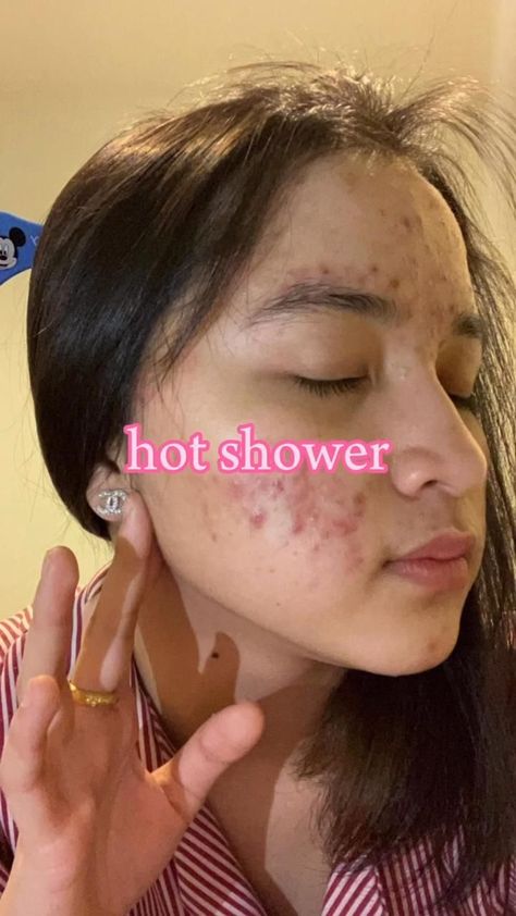 Hot Shower vs Cold Shower Hot Shower Vs Cold, Hot Shower Benefits, Hot Vs Cold Showers, Face Skin Care Routine Natural, Face Skin Care Aesthetic, Skin Care For Pimples, Cold Shower Benefits, Black Hair Mask, Skin Care For Dark Spots