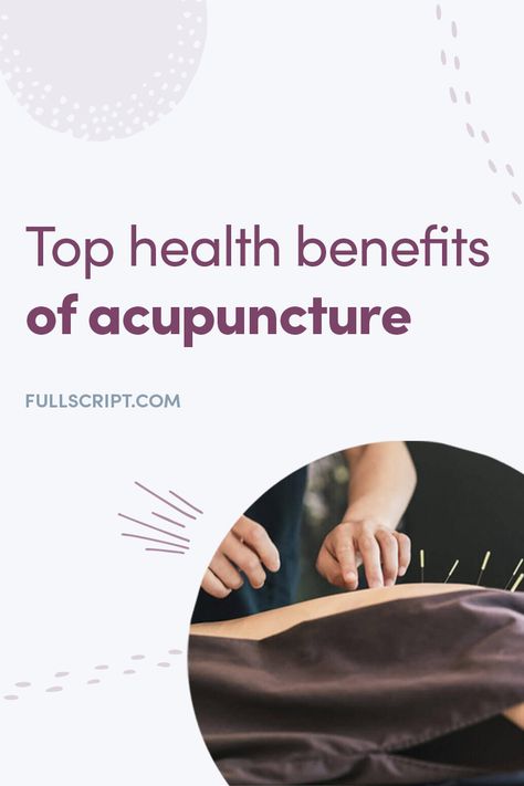 Benefits Of Acupuncture, Acupuncture Benefits Facts, Accupunture Benefits Health, Cupping Points, Traditional Chinese Medicine Acupuncture, Acupuncture Benefits, Balance Energy, Acupressure Massage, Cupping Therapy