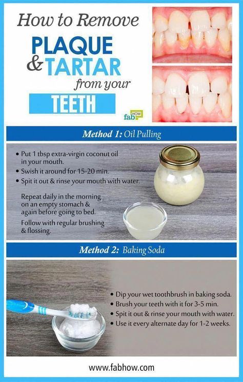 How to Remove Plaque and Tartar from Your Teeth - #Plaque #Remove #Tartar #Teeth #TakeCareOfOralHealth #ProperOralHygiene #BestOralCareAdvice #WhyIsOralCareSoImportant #HealthCareTips #WhatIsAOralCare #DoOralCare #HowToOralCare #WhyOralCareIsImportantForElderly How To Remove Plaque, Teeth Plaque, Tartar Teeth, Strong Teeth, Teeth Whitening Diy, Plaque Removal, Extra Virgin Coconut Oil, Teeth Health, Stronger Teeth