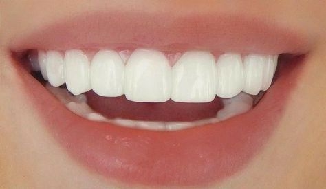 Teeth Aesthetic, Pretty Teeth, Studera Motivation, Perfect Teeth, Dream Vision Board, روتين العناية بالبشرة, Vision Board Manifestation, Life Vision Board, Color Corrector