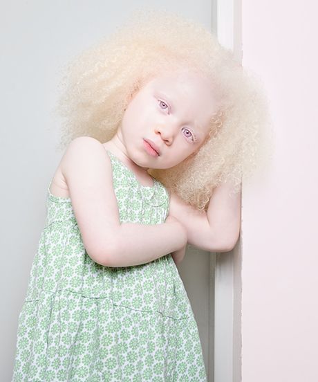 Albino People Photos Albinism Portraits | Here's what albinism really looks like. #refinery29 http://www.refinery29.com/albinism-photo-essay Albino People, Faces Pictures, Albino Girl, People Photos, Pictures Of People, Photo Series, Yule, Black Beauty, Eye Color