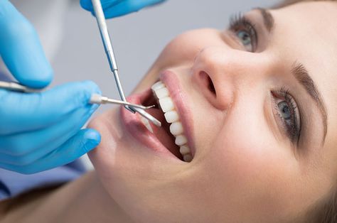 The Truth about Dental Cleaning - Glendale Dentist Dental Photos, Lost Tooth, Implant Dentistry, Emergency Dentist, Metal Post, Missing Teeth, Dental Cleaning, Dental Crowns, General Dentistry