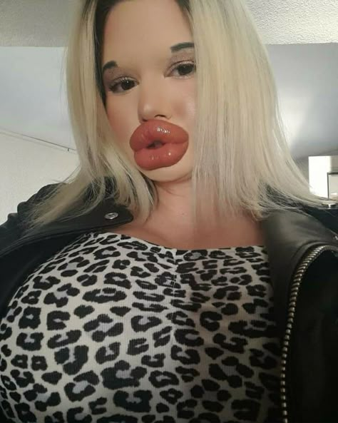 Bigger Lips Makeup, Bulgarian Women, Big Lips Natural, Fake Lips, Lip Filler, Under The Knife, Juicy Lips, Lip Piercing, Breast Augmentation