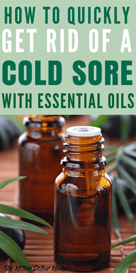 Natural Cold Sore Remedy That Really Works - How to Quickly Get Rid of a Cold Sore With Essential Oils Natural Cold Sore Remedy, Essential Oils For Colds, Cold Sores, Canker Sore, Cold Sores Remedies, Natural Healing Remedies, Cold Home Remedies, Cold Sore, Cold Remedies