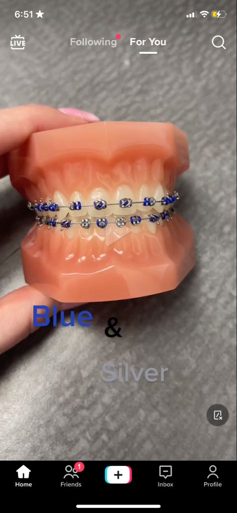 Braces Colors Navy Blue, Navy Blue Braces Teeth, Baby Blue Braces, Braces Navy Blue, Dark Blue Braces, Navy Blue Braces, Brace Ideas, Power Chains, Braces Colours