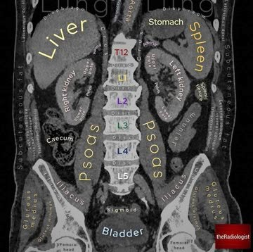 Punkty Spustowe, Medical Radiography, Sonography Student, Radiology Student, Medical Sonography, Radiology Technician, Radiology Imaging, Diagnostic Medical Sonography, Radiology Tech