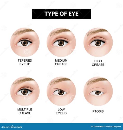 Type of eyelid crease illustration Eyelid Types, Women Infographic, Plasma Facial, Black Eyebrows, Reference Photos For Artists, Abstract Animal Art, Types Of Plastics, Cartoon Faces, Beauty Eyes