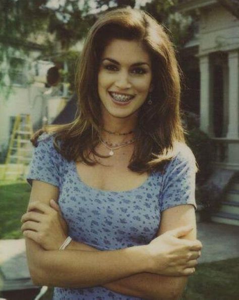 Cindy Crawford is listed (or ranked) 17 on the list 53 Celebrities You Would Never Guess Had Braces Celebrities With Braces, Braces Transformation, Braces Before And After, Braces Smile, After Braces, Pretty Teeth, Adult Braces, Celebrity Smiles, Braces Girls