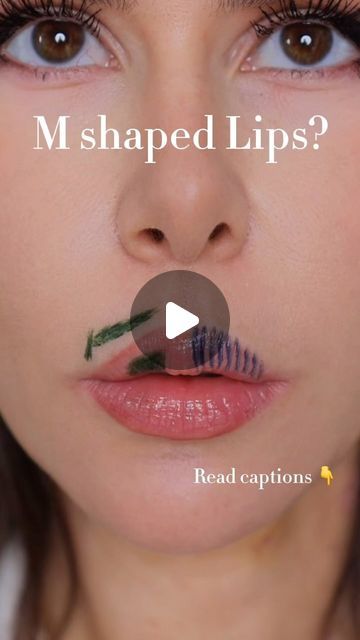 Dr Rebecka Gardell on Instagram: "To treat M-shape lips, it´s mose efficient to ONLY place filler where you have the concavities, i.e. the areas in the M shape where you can see that it goes inwards. 

But how is this possible? 

It´s not that difficult if you use a 27G cannula with a high precision technique. You draw on the lips where you see concave parts, enter from the side and move and place tiny droplets of filler only in the marked area. Voila! You have corrected the M shape.

If you use the stapling, filler will be placed in the concave parts, but filler will ALSO be placed in the areas above it.

That means that the relationship in terms of degree of projection wont change between the M part and the areas around it - and thus the shape of the lip will stay the same as before." Keyhole Lip Fillers, Keyhole Lips, Overfilled Lips, Keyhole Pout Lips Aesthetic, Keyhole Pout Lips, Keyhole Pout Lip Filler, Meant To Be, Lips, Reading