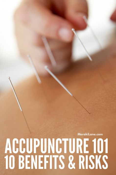 10 Health Benefits of Acupuncture for Your Mind and Body | What is acupuncture? What conditions is it used to treat, how does it work, what are the benefits, and are there any risks? Acupuncture points are thought to stimulate the central nervous system, stimulating the body's natural healing abilities and helping with chronic pain, stress, and even fertility. If you're new to this form of alternative medicine -- a component of traditional Chinese medicine -- this post has all the details! Acupuncture Benefits, Acupressure Mat, Scrub Corpo, Integrative Health, Acupuncture Points, Massage Techniques, Physical Wellness, Traditional Chinese Medicine, Holistic Wellness