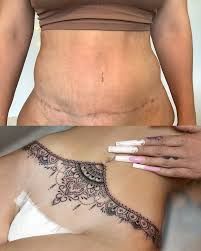 tummy tuck tattoo cover up - Google Search Tattoo Over Tummy Scar, Tummytuck Tattoo Coverup Women, Underboob Cover Up Tattoo, Tummy Tucks Tattoo Cover Up, Lower Belly Tattoos, Tummy Tattoo, Belly Tattoos, Tattoo Cover Up, Tattoo Cover