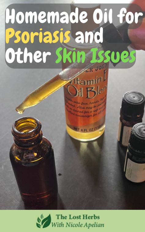 Here’s an all-in-one solution for managing any type of skin conditions you might be suffering from: Scaly Skin Remedy, Type Of Skin, Healing Salves, Homemade Oil, Scaly Skin, Herbal Infusion, Vitamins For Skin, Tea Tree Essential Oil, Skin Remedies