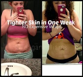 The Williams Family: How to Tighten Skin. Gonna try just can't get that bottom stomach skin sag to leave!!! Skin Tightening Stomach, Tighten Loose Skin, Tighten Skin, Tighter Skin, Glow Skin, Saggy Skin, Loose Skin, Body Wraps, Diy Body