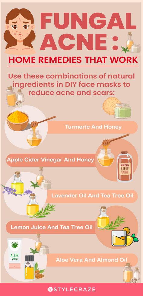 Cystic Acne Remedies, Blind Pimple, Fungal Acne, Acne Overnight, Acne Vulgaris, Natural Acne Remedies, Natural Acne, Home Remedies For Acne, Clear Skin Tips