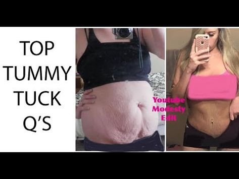 Over the last almost 6 years. I get LOTS of questionson a tummy tuck and the healing. So I wanted to do an updated Q&A of my top ask TT ... Tummy Tucks Recovery Tips, Mommy Makeover Surgery Recovery, Plastic Surgery Recovery, Tummy Tucks Recovery, Skin Removal Surgery, Glass Noodles Recipe, Mommy Makeover Surgery, Breast Lift Surgery, Brazilian Buttlift