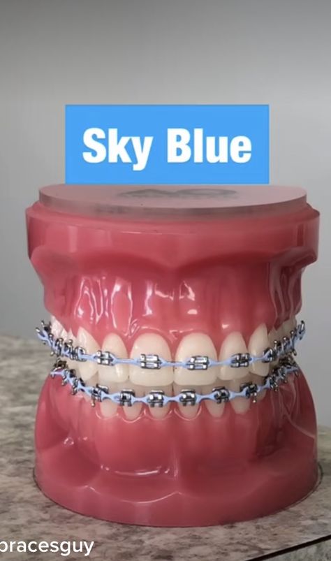 Braces Sky Blue, Periwinkle Braces, Brace Colors Ideas, Baby Blue Braces, Powerchain Braces Color, Sky Blue Braces, Good Braces Colors, Pretty Braces Colors, Braces Colors Aesthetic