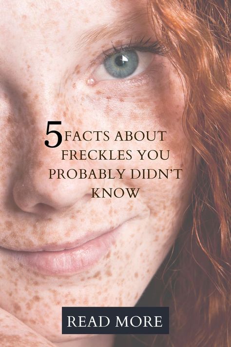 5 Facts About Freckles You Probably Didn’t Know Freckled Skin Makeup, How To Enhance Freckles Naturally, How To Make Your Freckles Pop, Tattoos Over Freckles, Makeup Ideas Freckles, Freckles Skin Care, Makeup For Girls With Freckles, Freckle Remover Before And After, Foundation For Freckled Skin