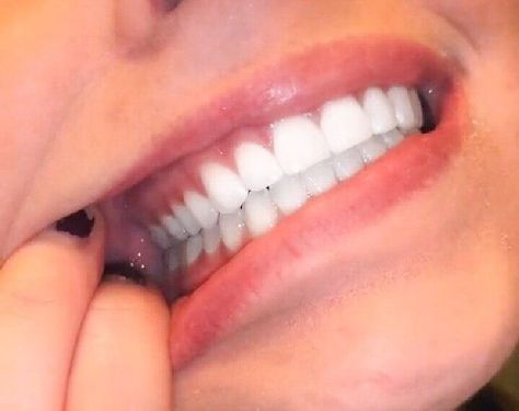 Smile Tips, Teeth Aesthetic, Pretty Teeth, Windows To The Soul, Beautiful Teeth, Wish Board, Perfect Teeth, Manifesting Vision Board, Lashes Mascara