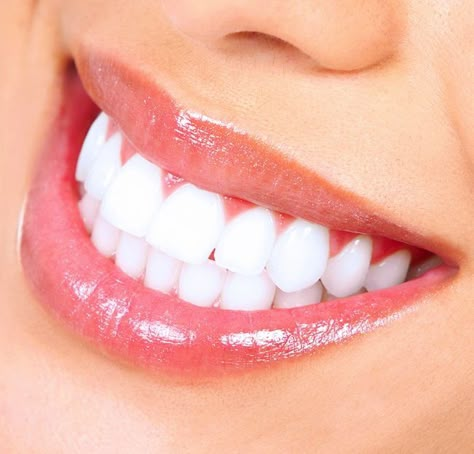 Teeth Whitening Mouthwash, Baking Soda Teeth Whitening, Teeth Whitening Dentist, Activated Charcoal Teeth Whitening, Teeth Whitening Homemade, Black Teeth, Charcoal Teeth Whitening, Teeth Whitening Gel, Teeth Whitening Strips