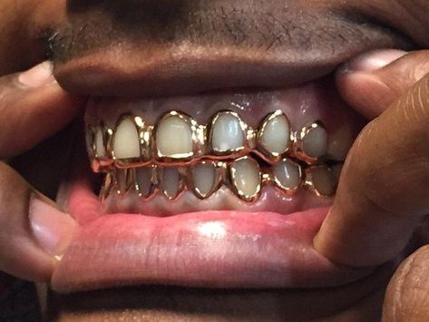 Open Face Grillz, Girl Grillz, Grillz Teeth, Gold Grill, Diamond Teeth, Gold Grillz, Grills Teeth, Tooth Gem, Gold Teeth