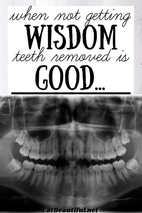 Wisdom Teeth Recovery, Impacted Wisdom Teeth, Teeth Surgery, Impacted Tooth, Eat Beautiful, Wisdom Tooth Extraction, Dry Socket, Veneers Teeth, Strengthen Teeth