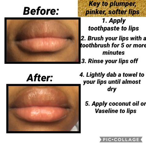 How To Get Plum Lips Naturally, Plum Lips Natural, How To Have Nice Lips, How To Get Bigger Lips, How To Get Soft Lips, Lighten Lips, Feminine Baddie, Bigger Lips Naturally, Diy Lip Plumper